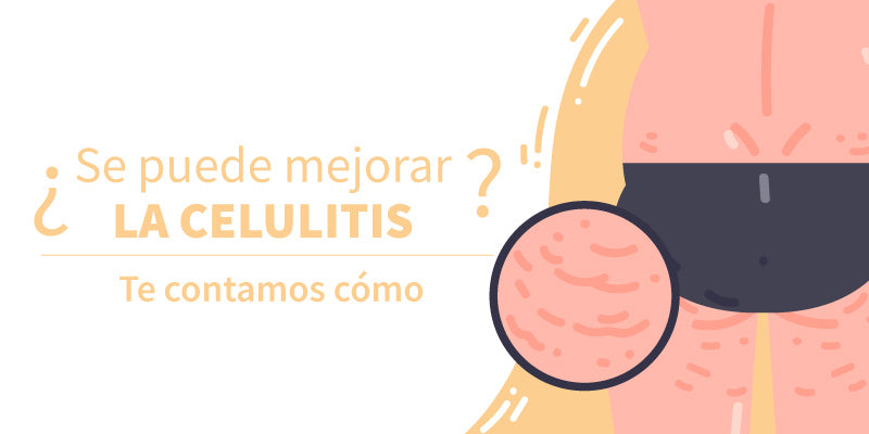 ¿Se puede mejorar la celulitis? Te contamos cómo