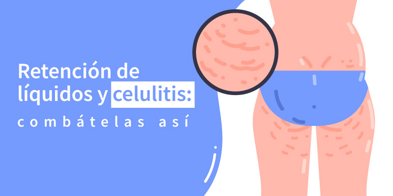 Retención de líquidos y celulitis: combátelas así